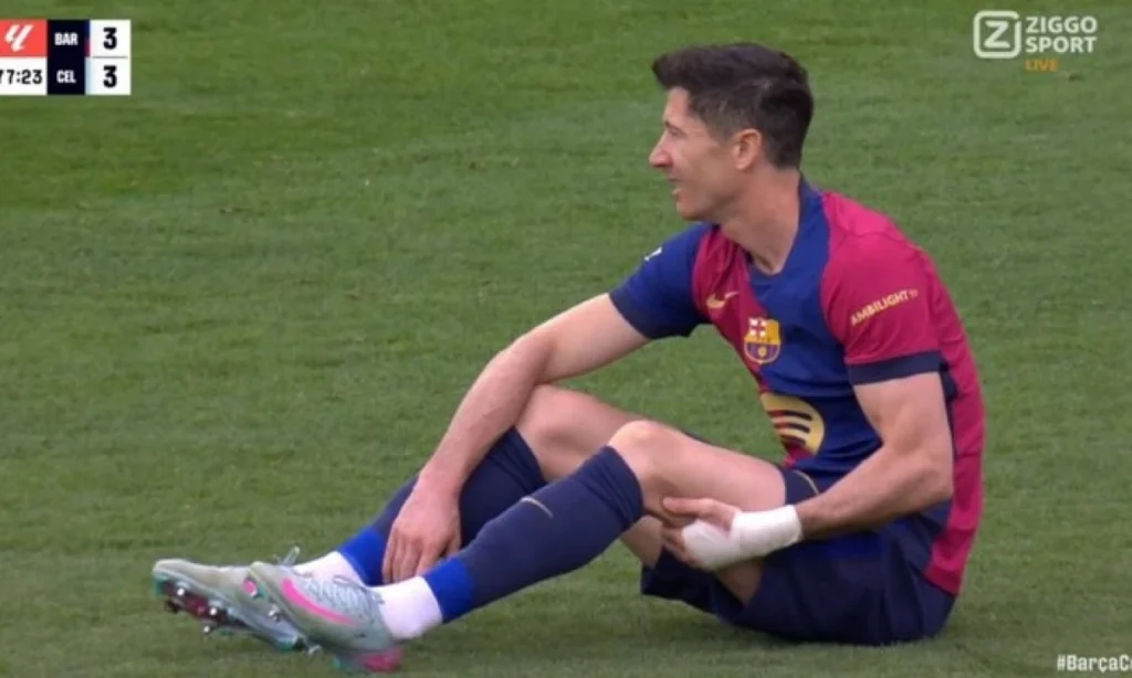 Lewandowski en peligro: posible rotura de grado I